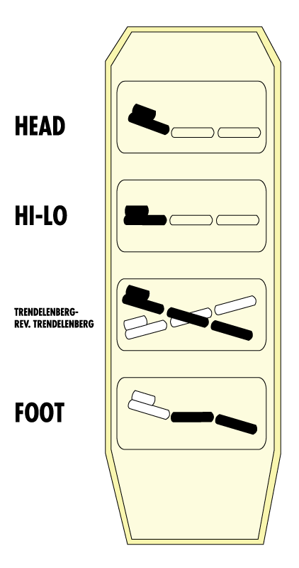 REMOTE